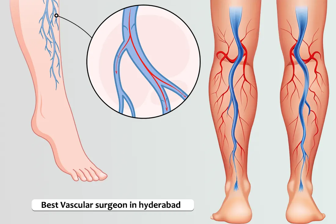 Vascular Surgery